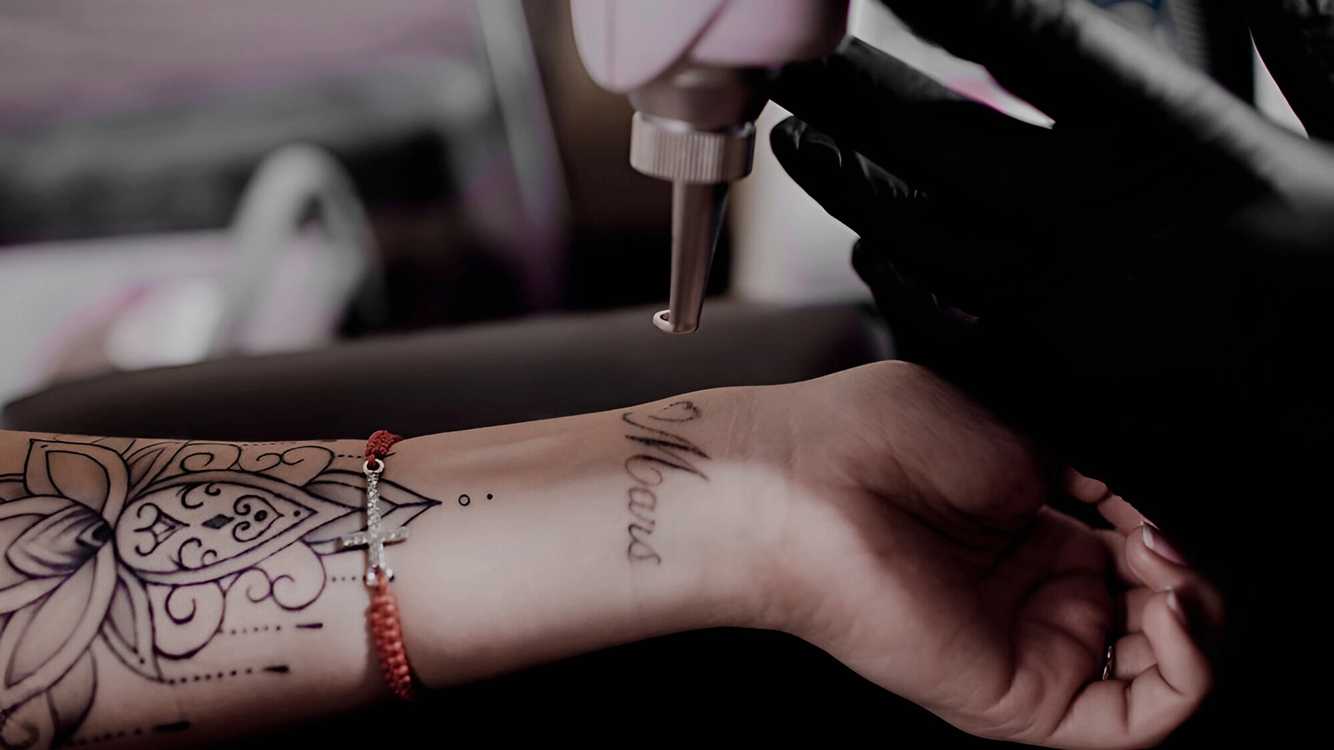 Suppression de Tatouage au Laser